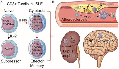 CD8+ T-Cells in Juvenile-Onset SLE: From Pathogenesis to Comorbidities